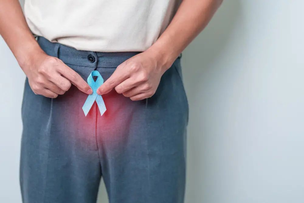 Prostate cancer awareness ribbon symbol near male pelvic area at Krishna Cancer Hospital Bhopal.