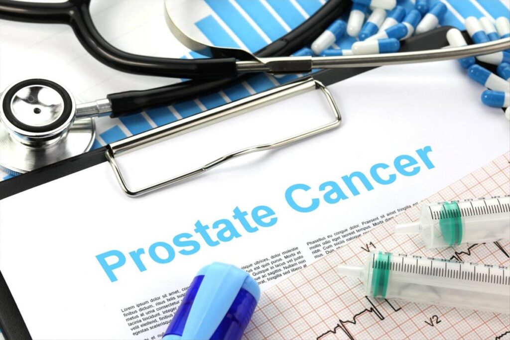 Prostate cancer diagnosis report with medical tools at Krishna Cancer Hospital Bhopal.